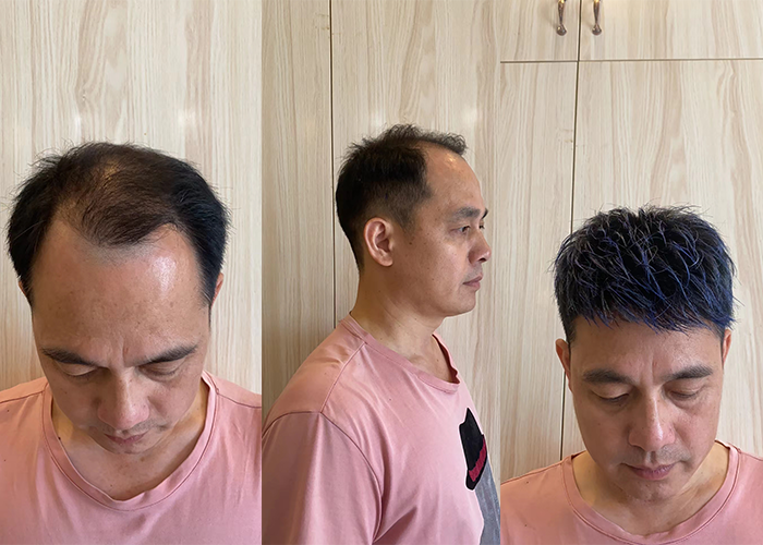 上头效果非常好!人瞬间就年轻了