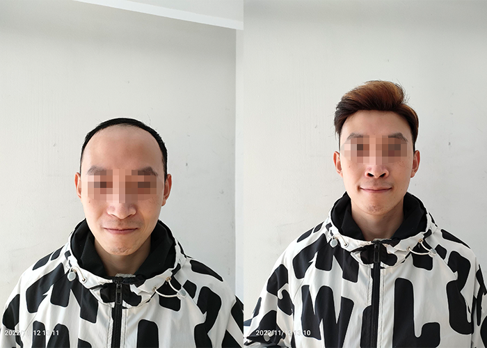 北京假发实体店哪家最好？（参考过来人评论）