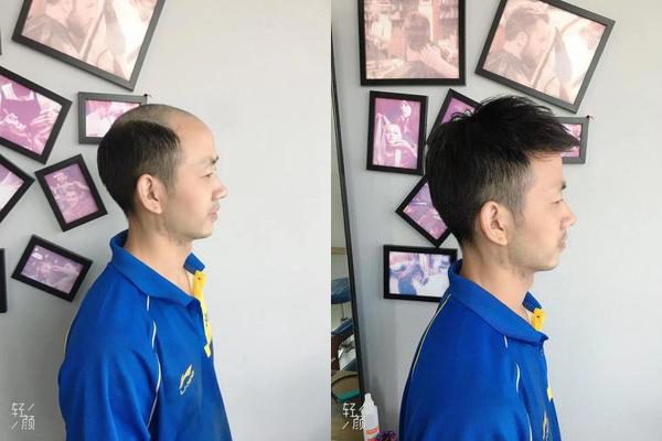 厦门假发实体店哪家好？