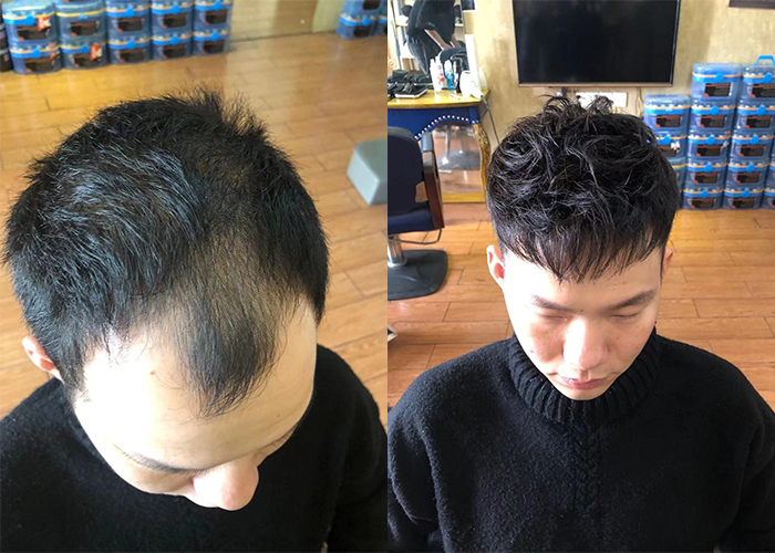 杭州假发定制哪家最好？（过来人经验给你答案）