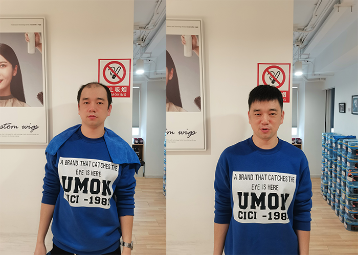 极客侠假发补发效果
