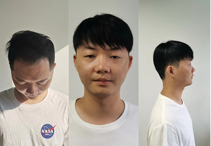 昆明假发实体店哪家好？（过来人揭晓答案）