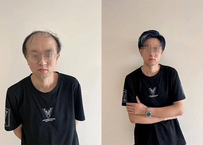 极客侠假发定制的售后服务也很好