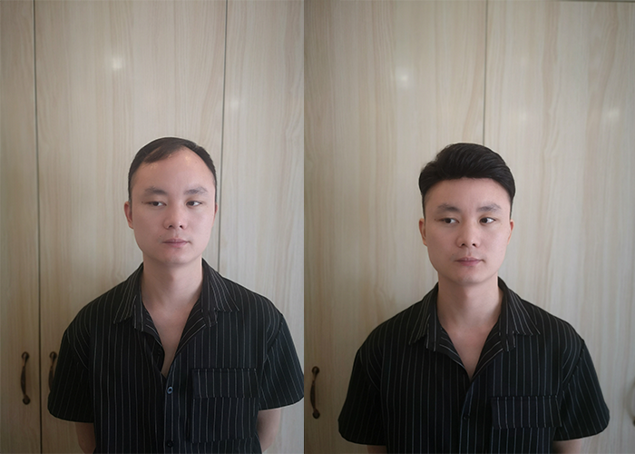 长春哪里买假发比较好？（过来人是这样说的）