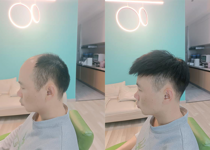 上海定制假发实体店哪家好？（用过的是这样说的）