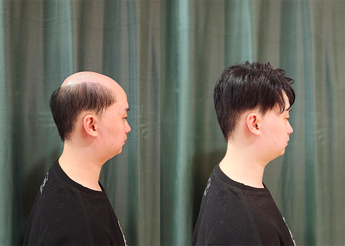 济南市真发丝假发哪里有？（济南市卖真发丝的假发店）