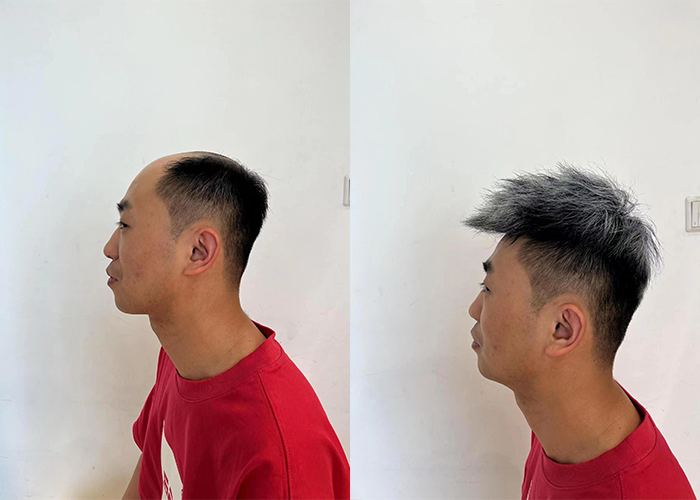极客侠的服务真的很贴心,从咨询到测量、设计再到最后的佩戴指导