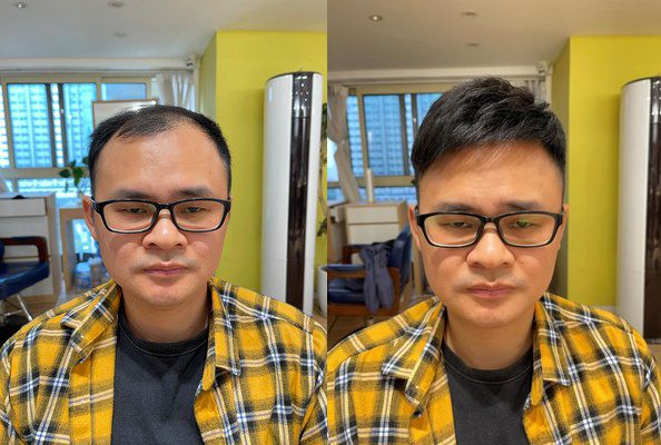 上海的假发店哪家最好？（过来人告诉你真相）