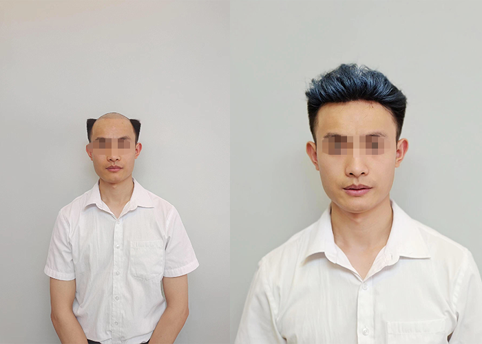 极客侠家的假发,那手感跟真的一样一样的