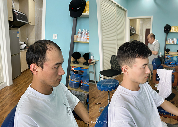 银川假发专卖哪家最好？（参考过来人评价）