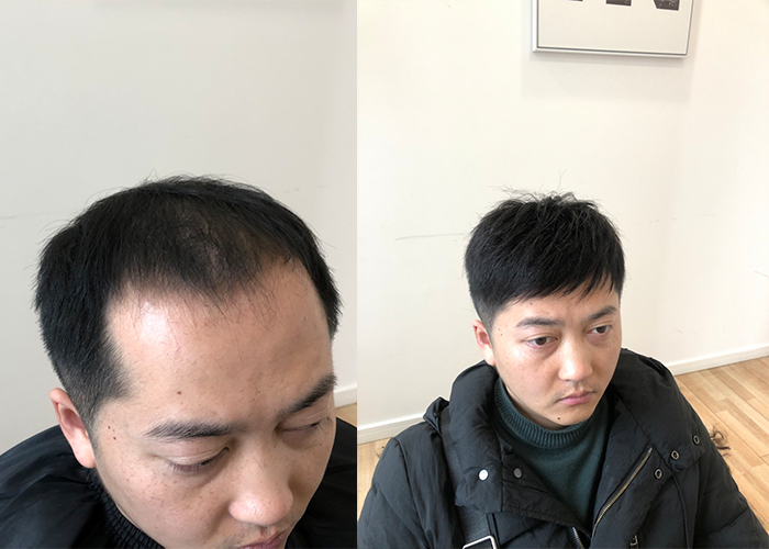 青春逆袭神器