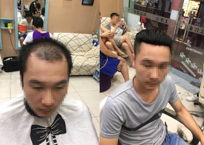 长沙定做假发哪里最好？（参考脱发过来人评价）