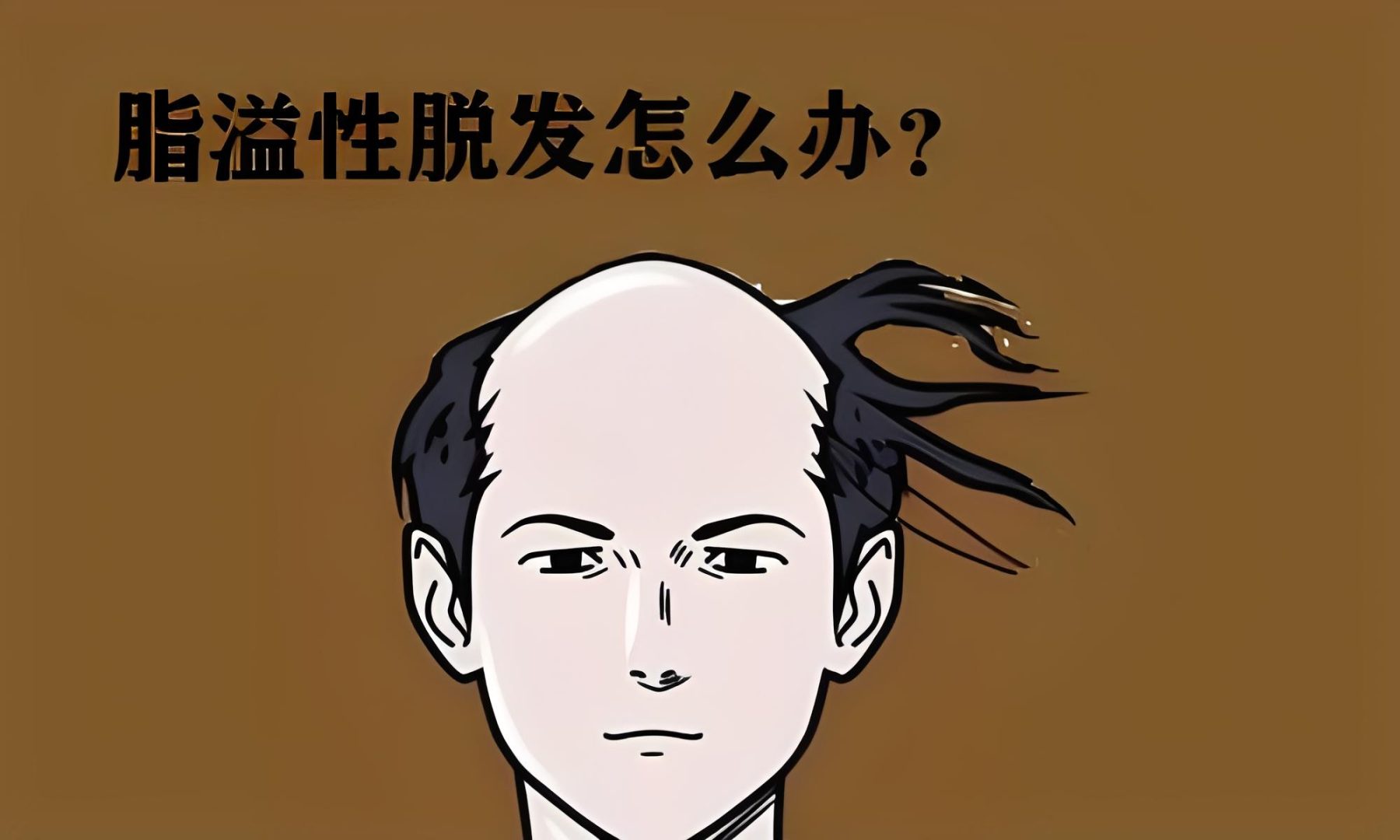 治疗溢脂性脱发的偏方