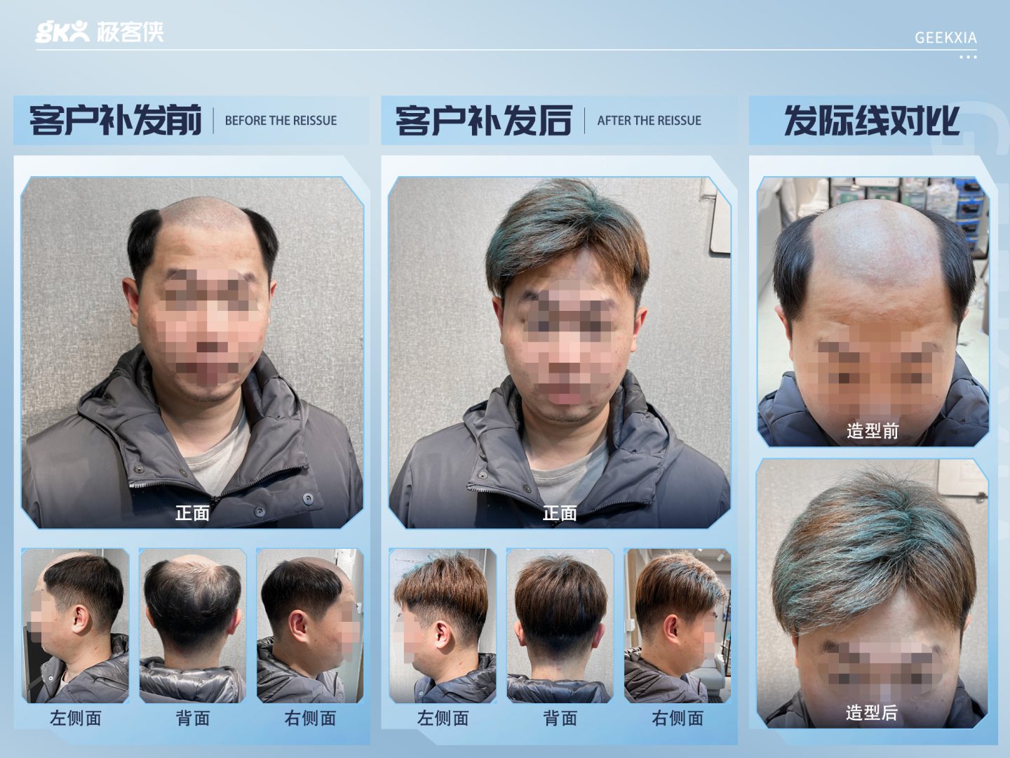 补发效果展示