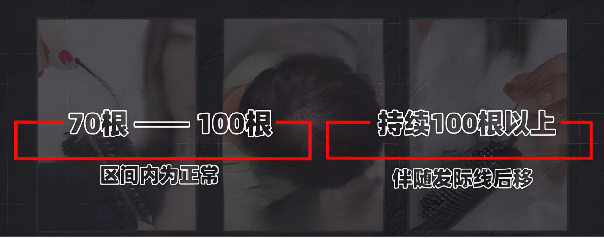如何自测脱发程度？