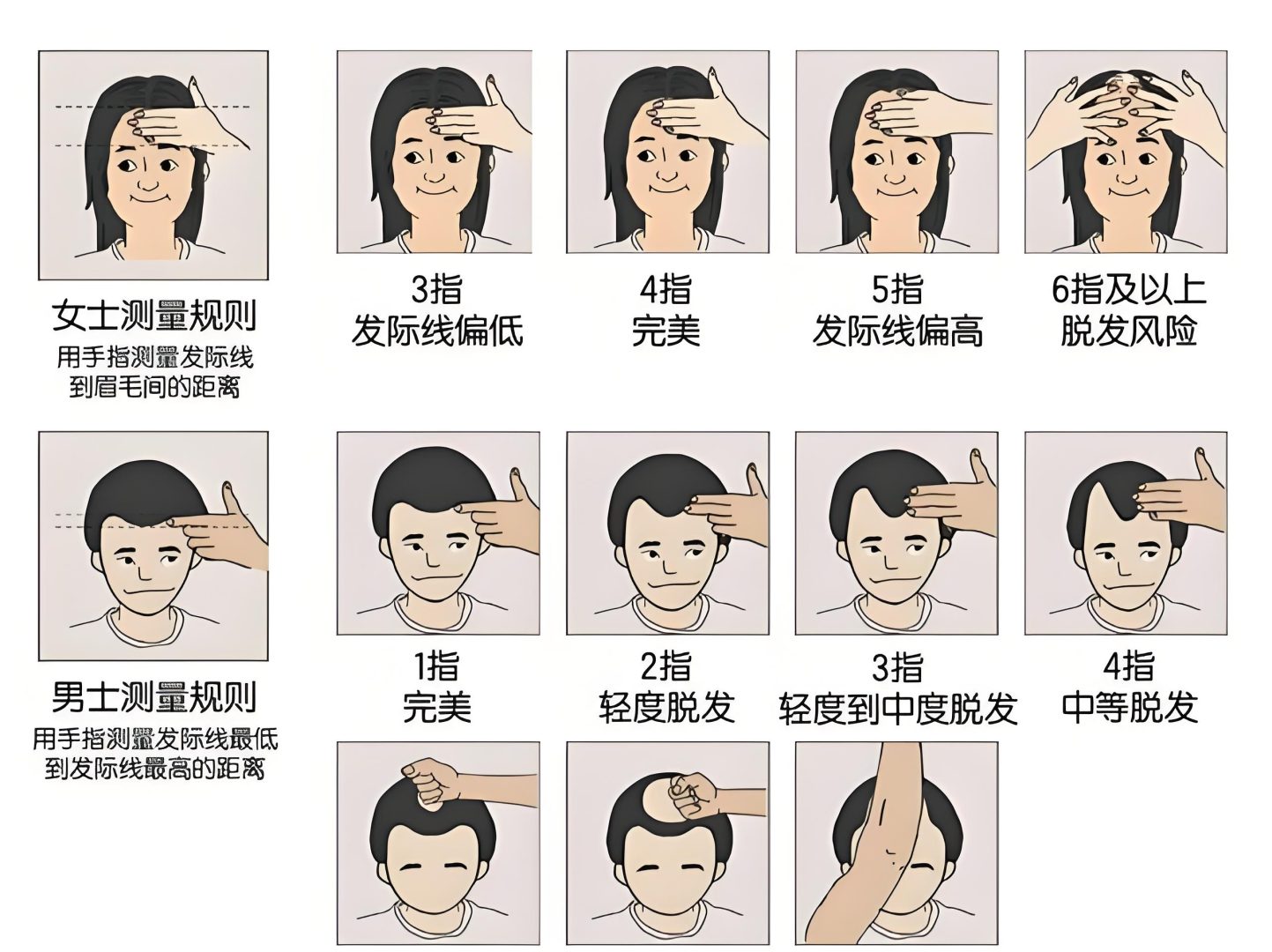 如何自测脱发程度?