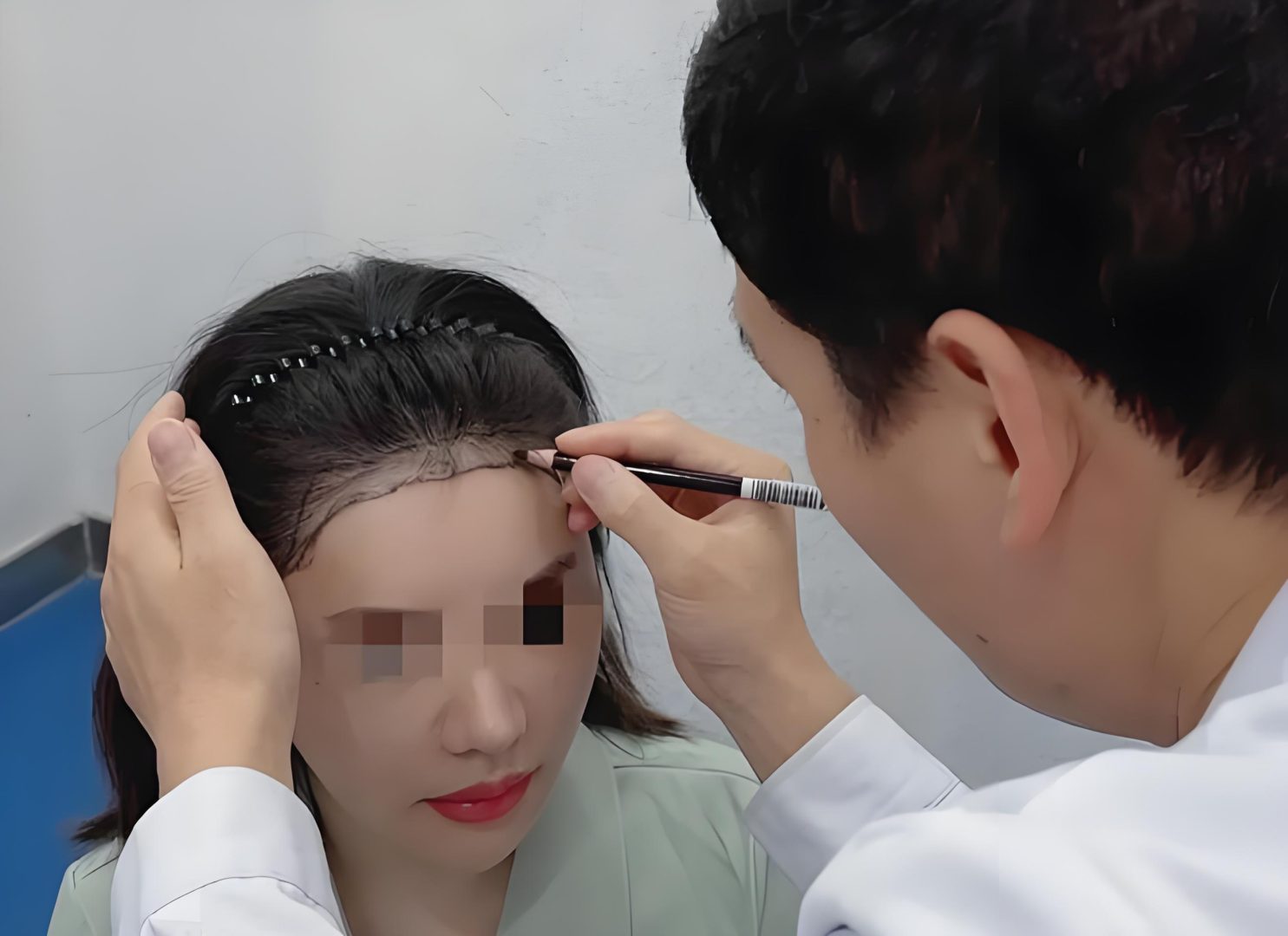 治疗脱发最有效的方法