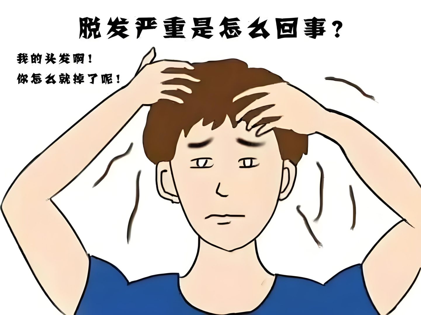 植发2500单位要多少钱?(值发2500单位价格参考)