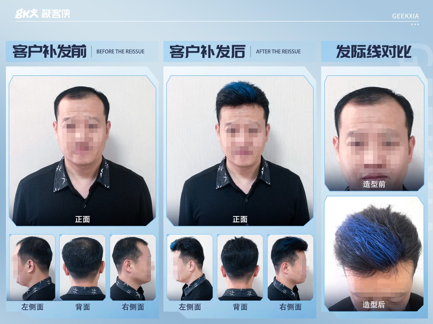 假发补发效果