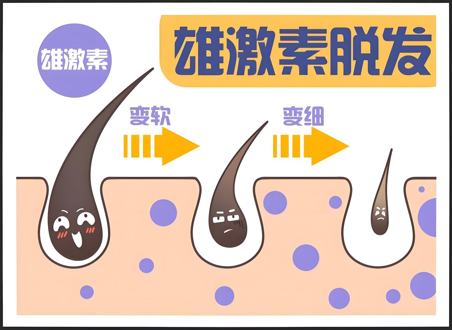 毛囊状态