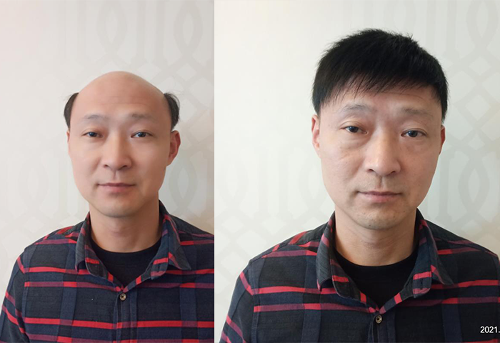 假发佩戴效果
