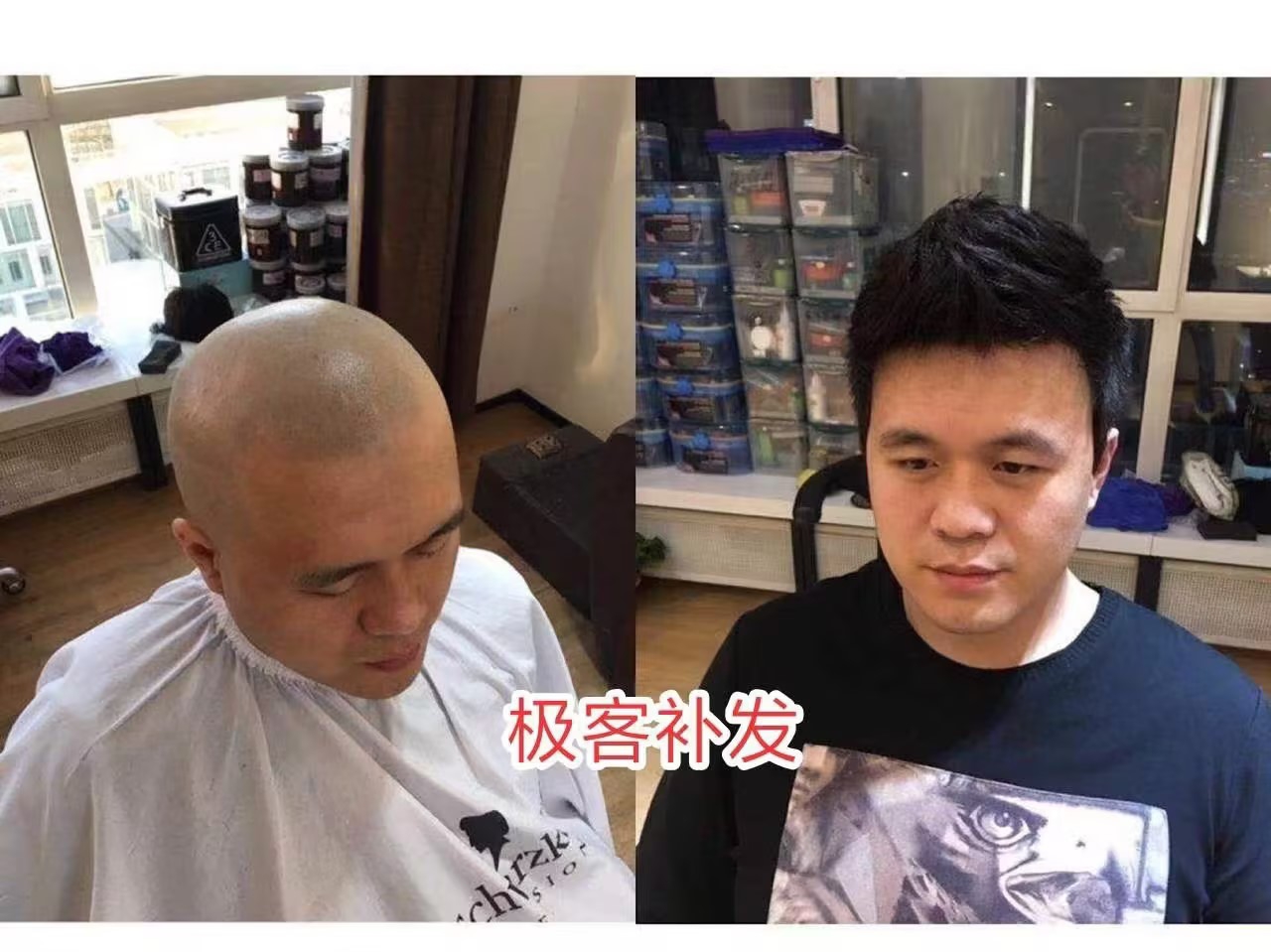 秃头戴假发效果