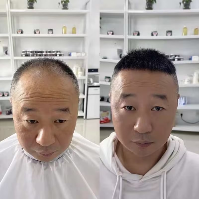 假发遮白发效果