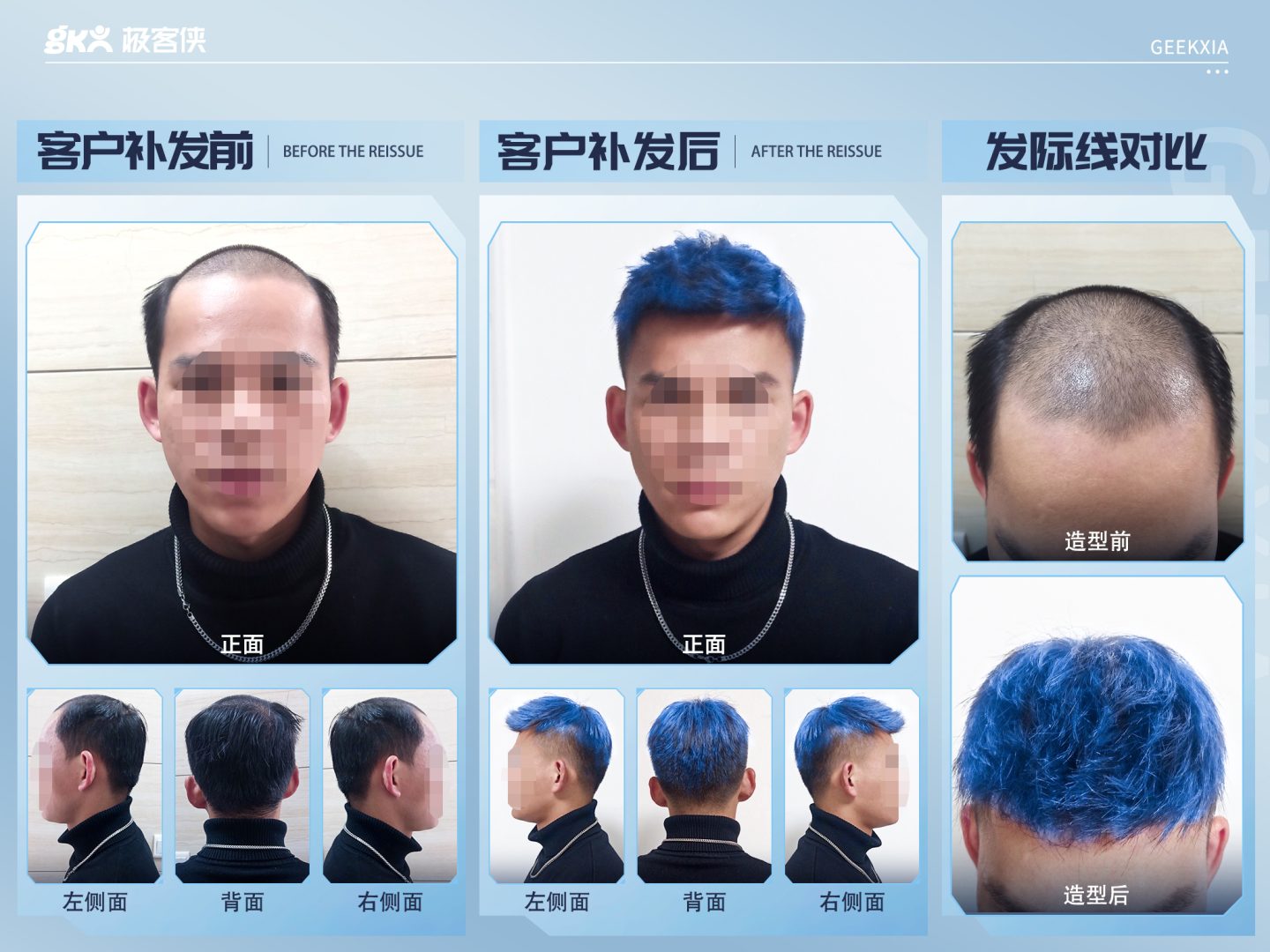 假发补发