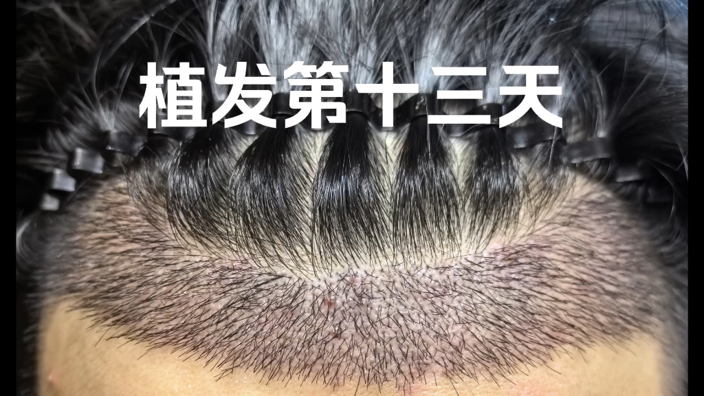 头发不自然生长