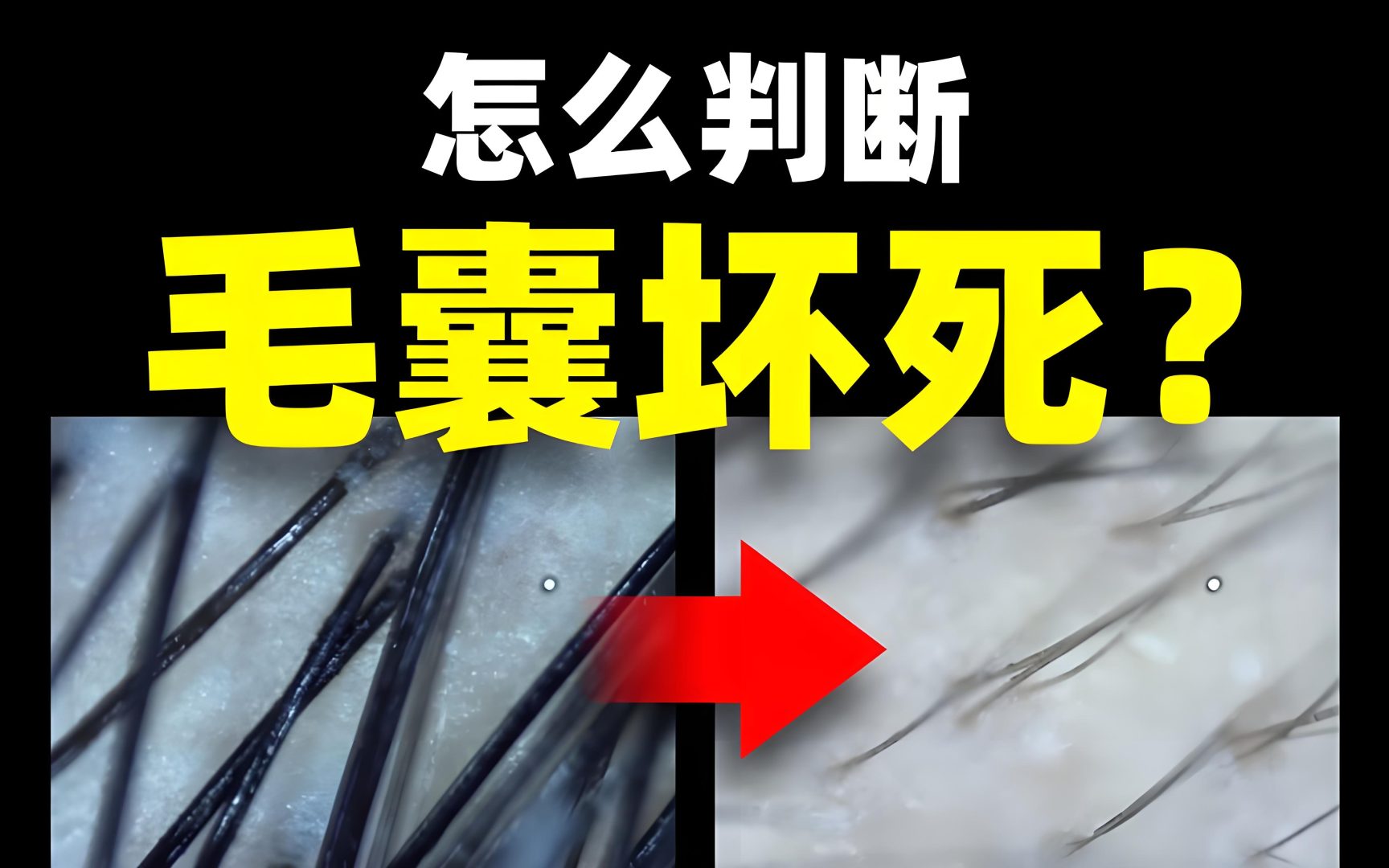 影响因素
