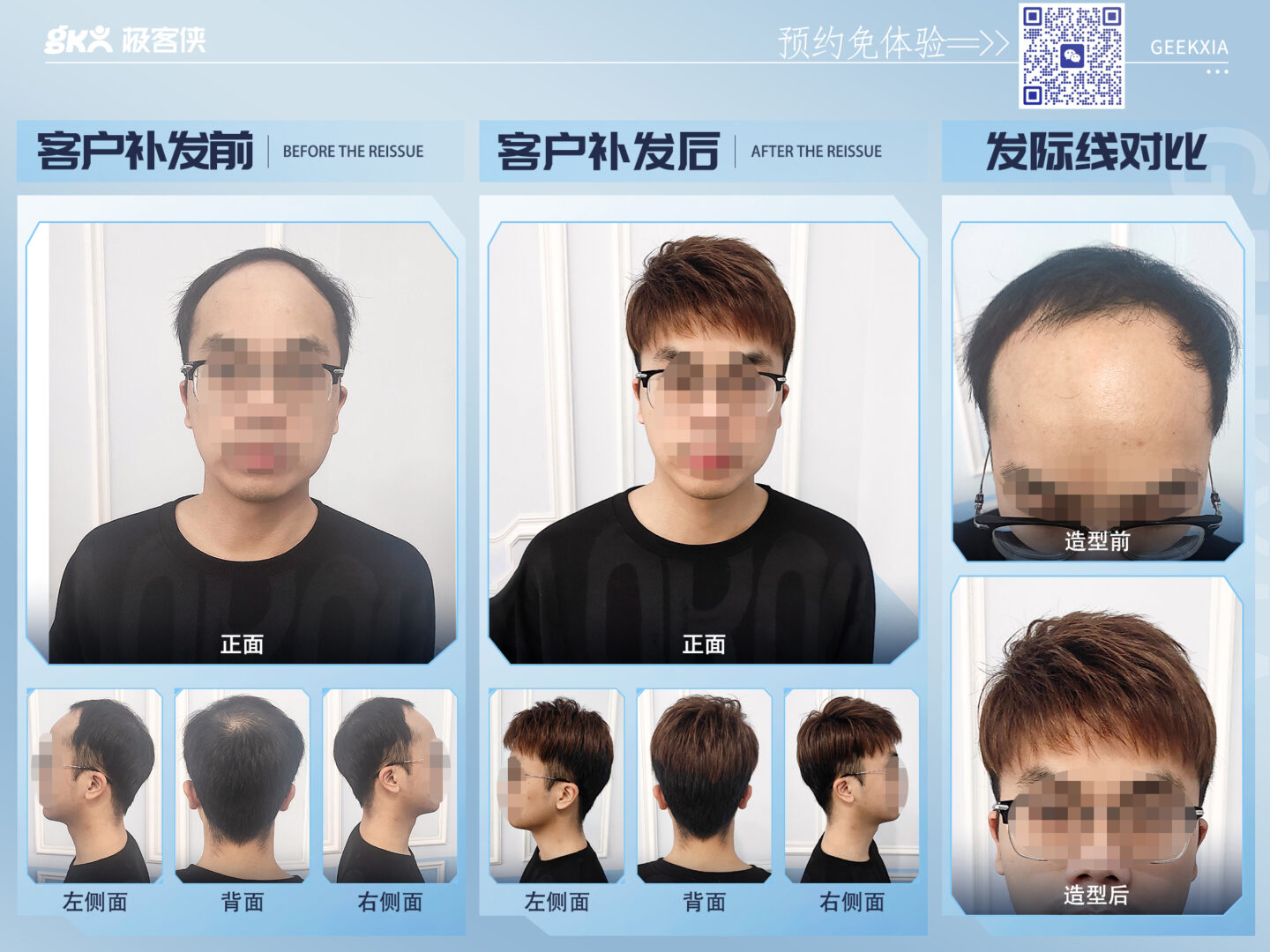 发际线高佩戴假发效果