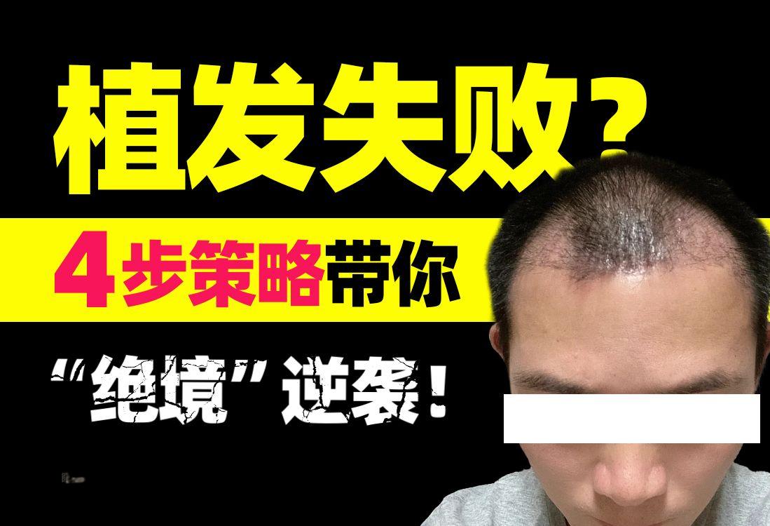 ☠后悔莫及：植发失败后的真实故事与防骗指南