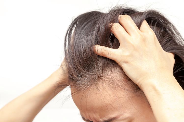 李女士的植发遗憾