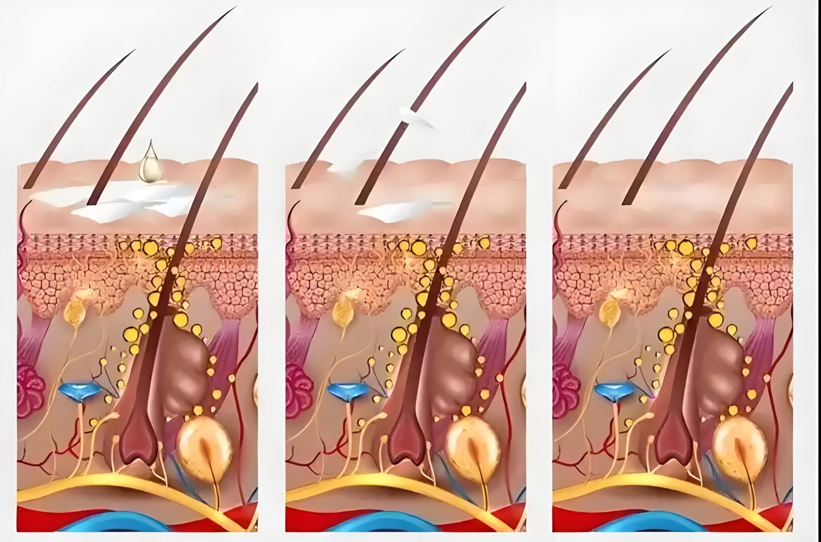 ?戴假发有什么不好的地方？（戴假发的朋友一定要懂这些）