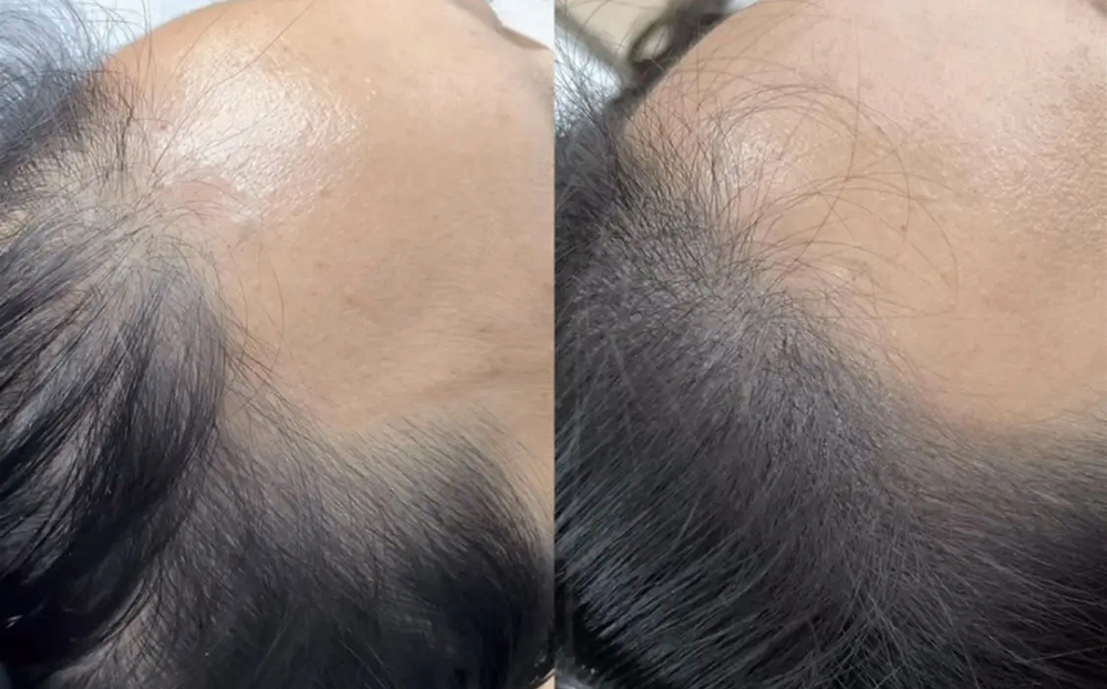 美丽陷阱的纹发技术密码
