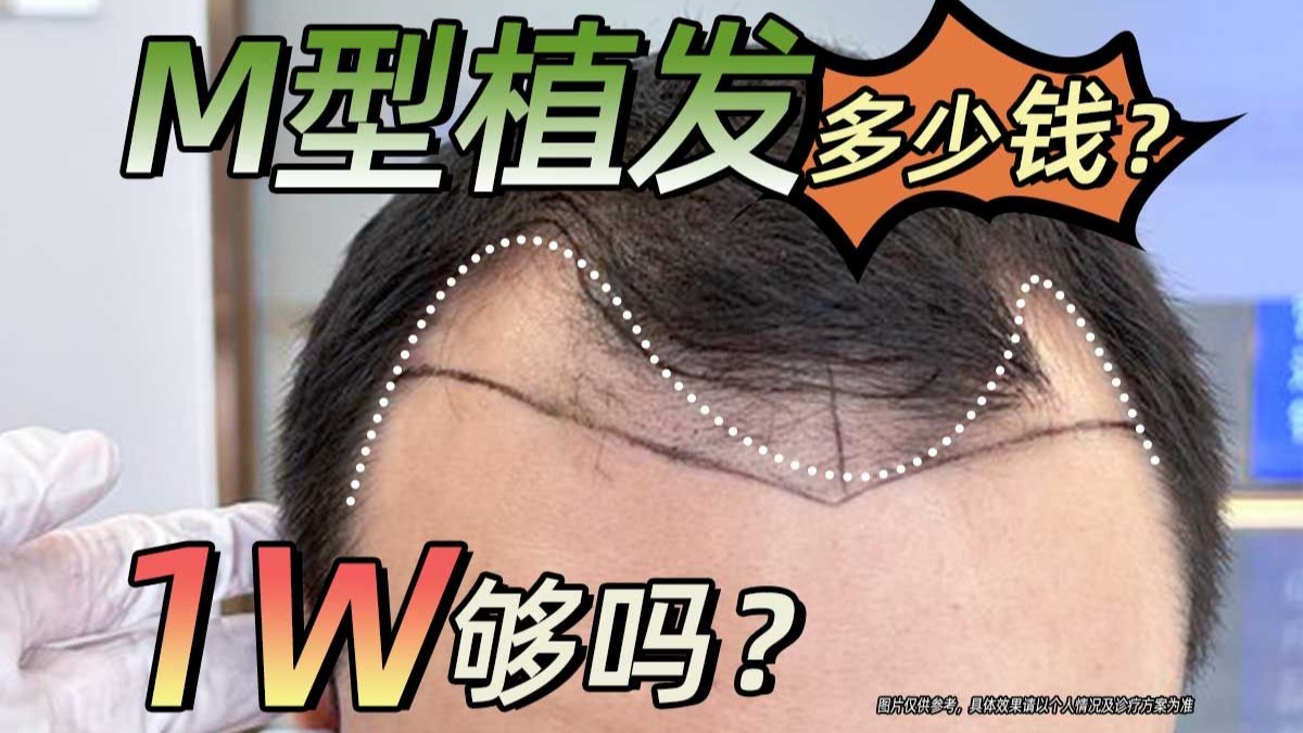 植发机构的五大致命陷阱
