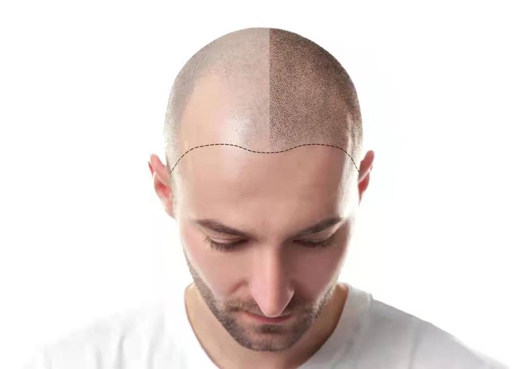 给考虑者的实用建议