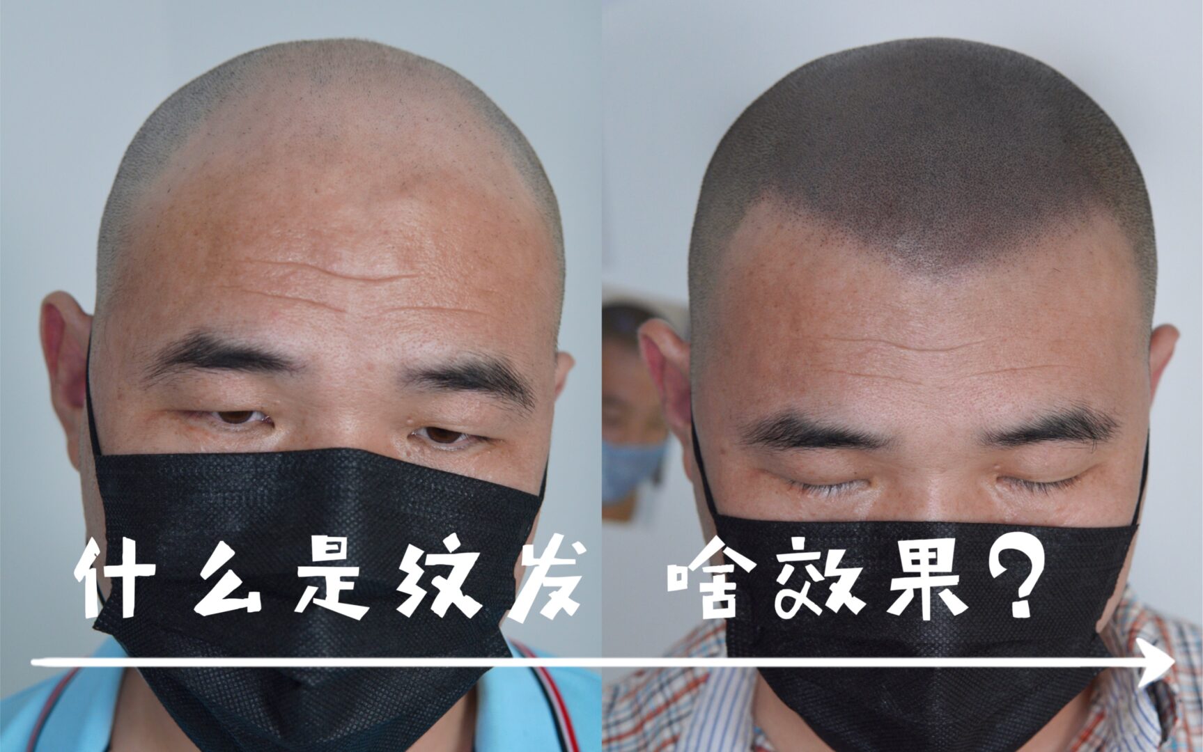 纹发的"前世今生"