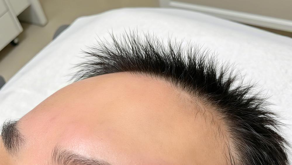 破局指南:如何识破“存活率陷阱”