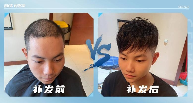 头发稀少佩戴极客侠假发前后效果对比